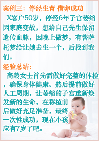 法国借卵试管